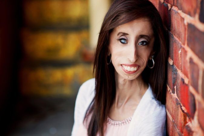 Lizzie Velasquez
